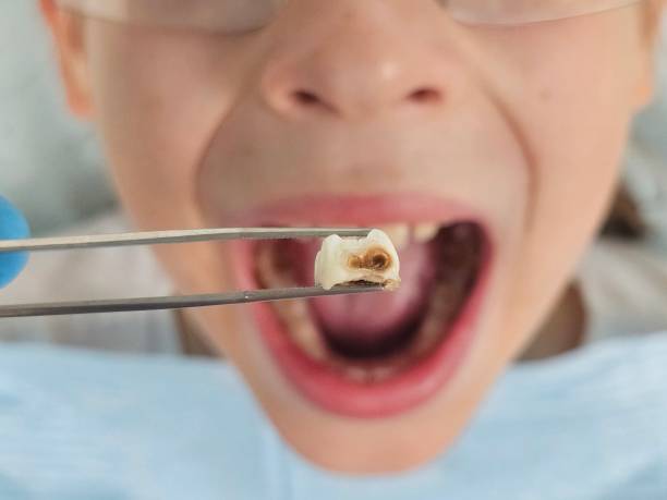 Best Cosmetic Emergency Dentistry in Texarkana, TX